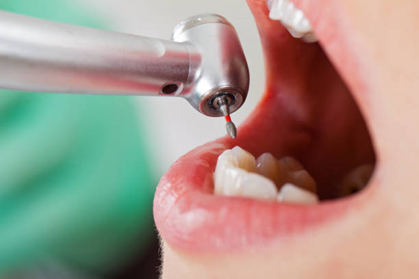 Best Broken Tooth Emergency  in Three Forks, MT